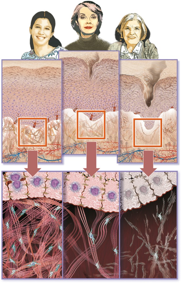 Skin Aging